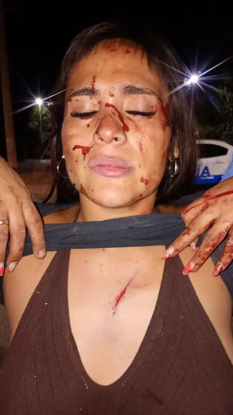 Le reclamó dinero a su hermano y terminó atacada con un machete en Cipolletti: "Temo por mi vida"